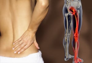webmd_rm_photo_of_lower_back_pain